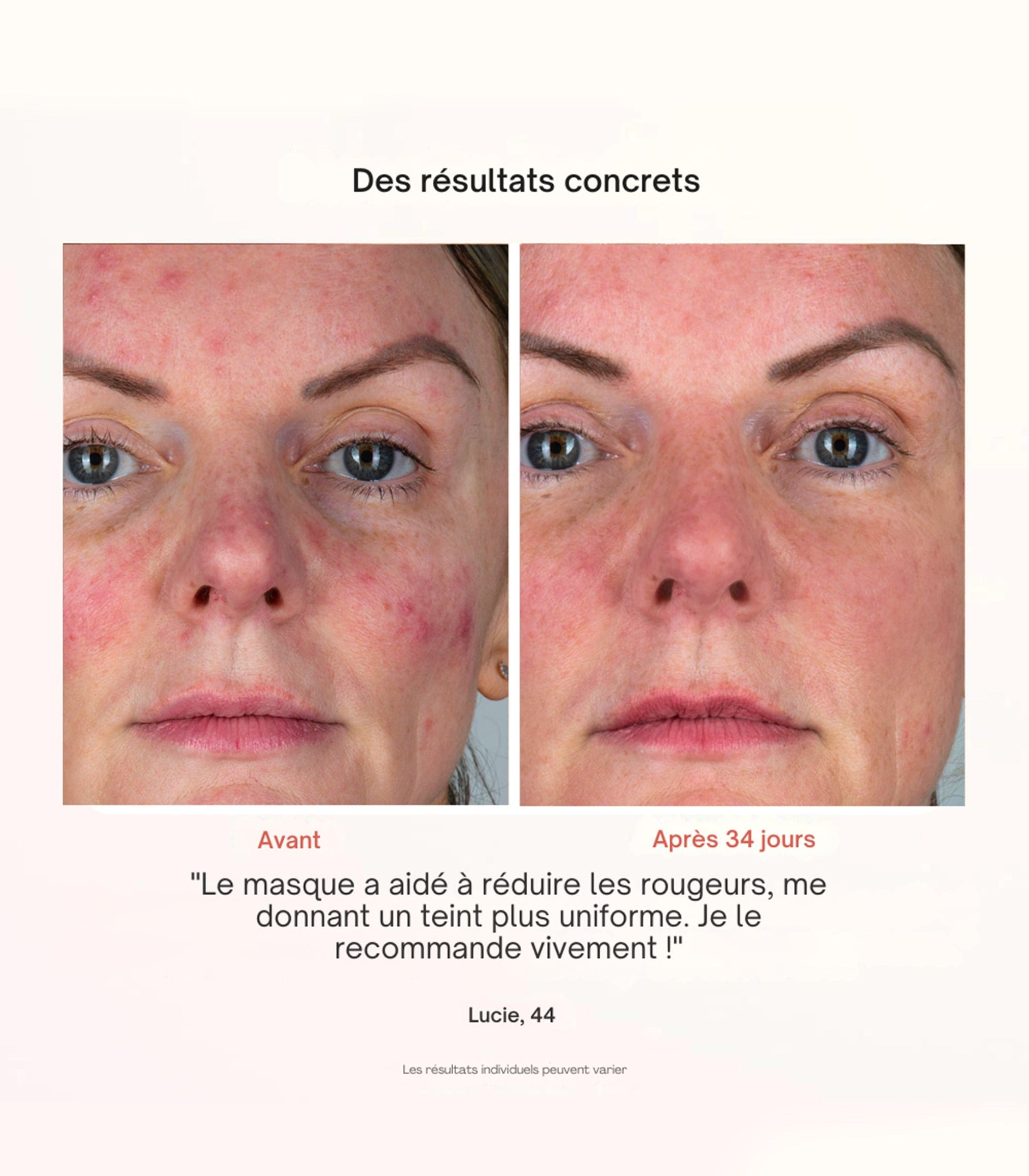 Essential® LED-MASKE – ROTLICHTTHERAPIE