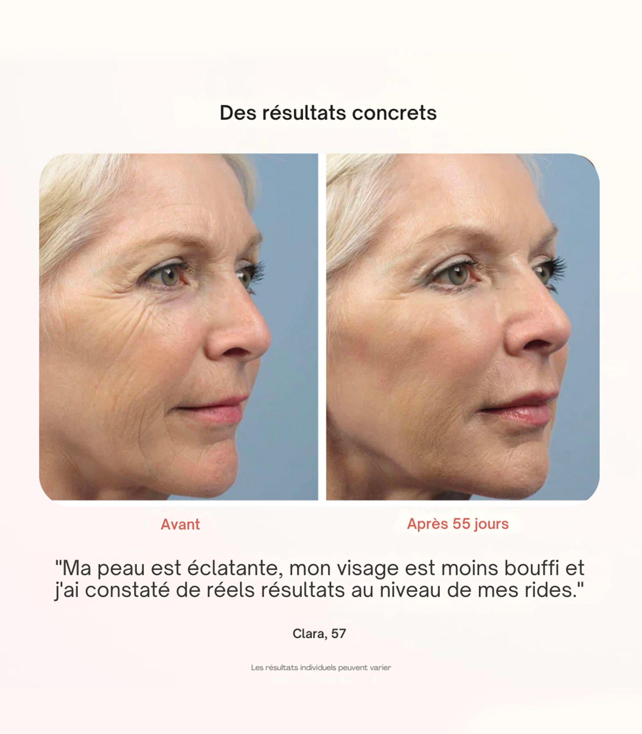 Essential® LED-MASKE – ROTLICHTTHERAPIE